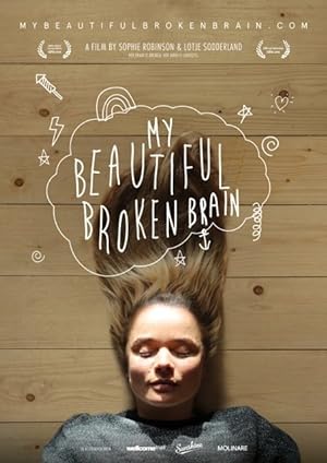Cover image of the movie My Beautiful Broken Brain (2014)
